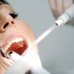 endodonzia_devitalizzazione_dente