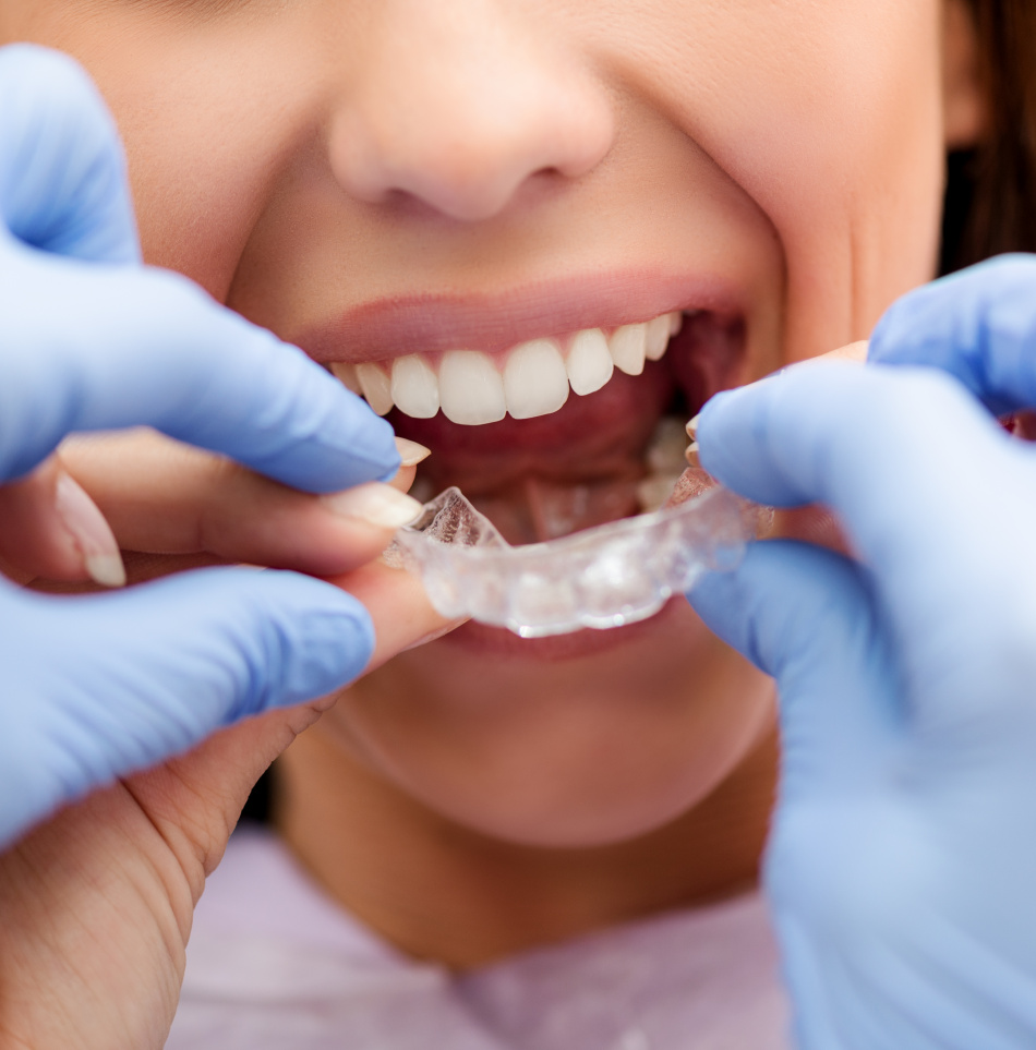 Denti storti? L'ortodonzia ti farà tornare a sorridere!