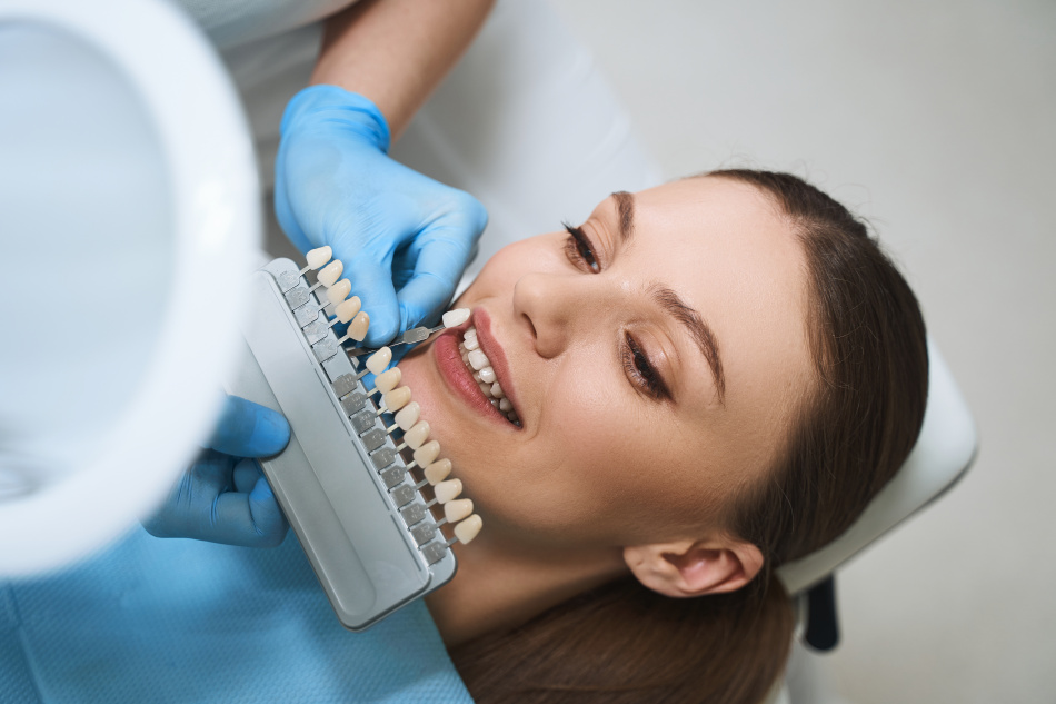 Faccette dentali: 5 cose da sapere prima del trattamento